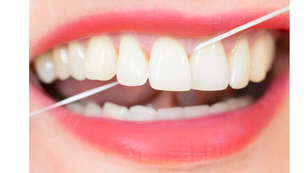 Utilisation du fil ou des brossettes interdentaires pour nettoyer autour de la couronne