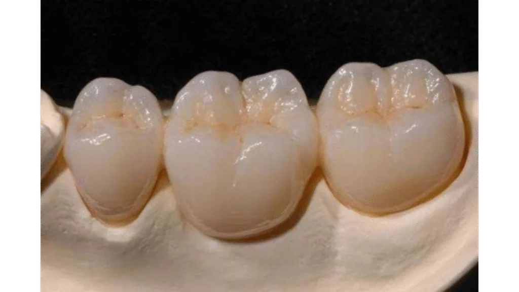Essayage et ajustements