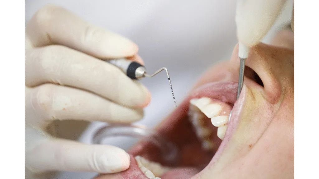 Diagnostic initial : Le bilan parodontal