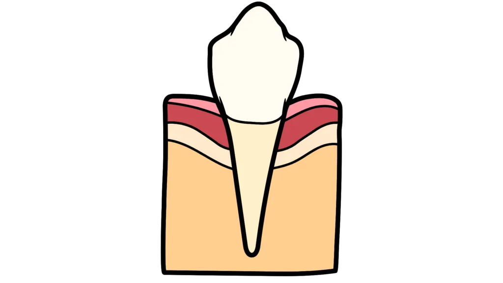 Canines (4 au total, 2 par mâchoire)
