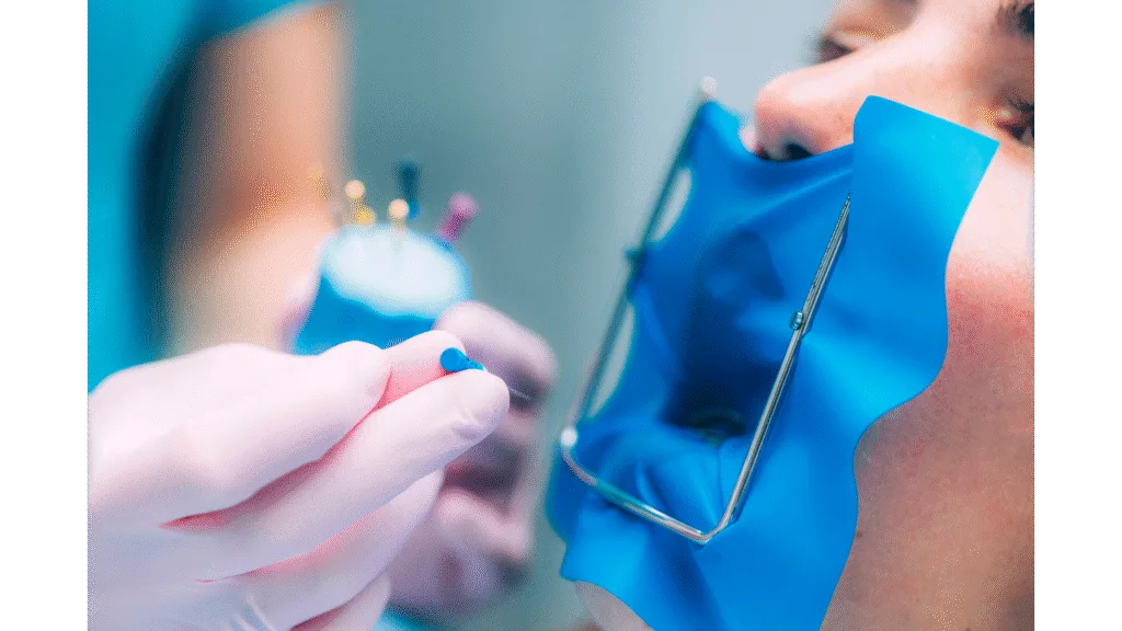 Retraitement endodontique